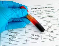 Синдром цитолиза в биохимическом анализе крови thumbnail
