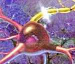 Отек клеток нервной системы thumbnail