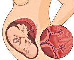 Раннее созревание плаценты при беременности на 32 неделе thumbnail