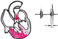 Анализ крови при легочном сердце thumbnail