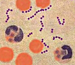 Стрептококковые заболевания с развитием стойкого иммунитета thumbnail