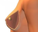 Жировик в грудине у женщин thumbnail