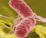 Кишечные бактериальные инфекции сальмонеллез thumbnail