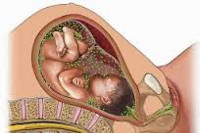 Развитие ребенка перенесшего внутриутробную инфекцию thumbnail