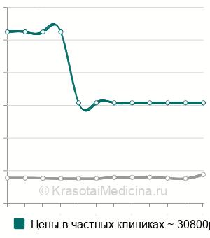 Средняя стоимость ОФЭКТ головного мозга в Москве