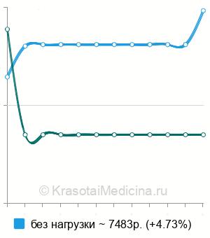 Средняя стоимость ОФЭКТ миокарда в Москве