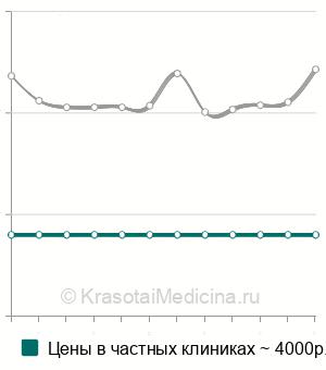 Средняя стоимость ОФЭКТ щитовидной железы в Москве