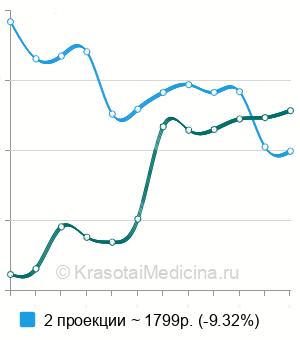 Средняя стоимость рентген кисти в Москве