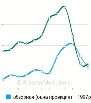 Средняя стоимость рентген грудной клетки в Москве