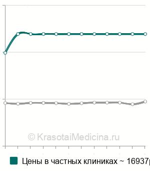 Средняя стоимость эндосонография желчных путей в Москве
