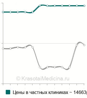 Средняя стоимость эндосонография 12-перстной кишки в Москве