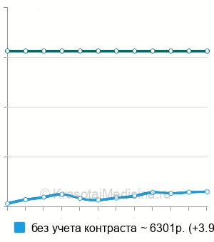 Средняя стоимость КТ гипофиза в Москве
