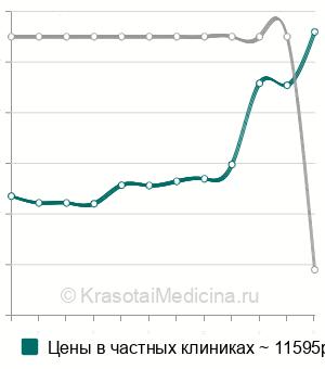 Средняя стоимость МРТ черепных нервов в Москве
