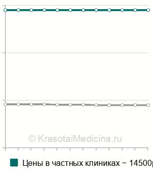 Средняя стоимость МРТ-диффузия головного мозга в Москве