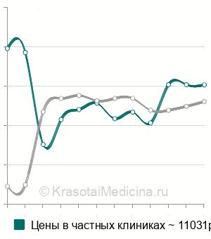 Средняя стоимость МРТ-перфузия головного мозга в Москве