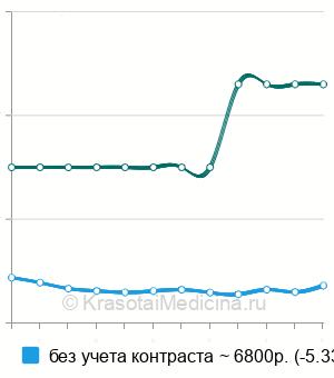 Средняя стоимость МРТ щитовидной железы в Москве