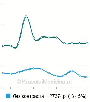 Средняя стоимость МРТ всего тела в Москве