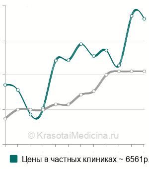 Средняя стоимость МРТ кисти в Москве