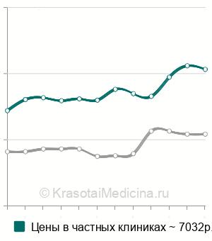 Средняя стоимость МРТ кисти в Москве