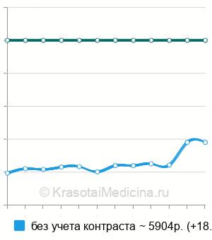 Средняя стоимость МРТ краниовертебрального перехода в Москве