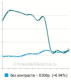 Средняя стоимость МРТ крестцово-подвздошных сочленений в Москве