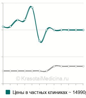 Средняя стоимость МРТ плода в Москве
