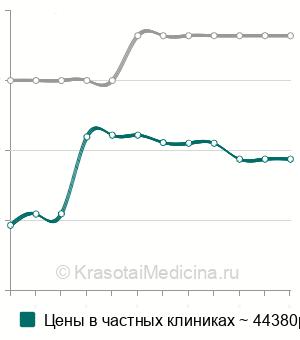 Средняя стоимость пренатальный тест на отцовство в Москве