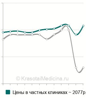 Средняя стоимость биохимия кала на дисбактериоз в Москве