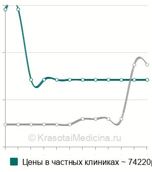 Средняя цена на генодиагностику рабдомиолиза (миоглобинурии) в Москве