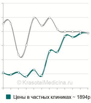 Средняя цена на госпитальный комплекс (ВИЧ, сифилис, гепатит В и С) в Москве