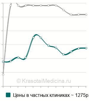 Средняя стоимость анализ на антитела к экстрагируемым ядерным антигенам (ENA) в Москве