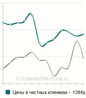 Средняя стоимость анализ на антинуклеарный фактор (АНФ) в Москве