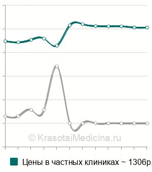 Средняя стоимость анализ на антитела к нуклеосомам в Москве