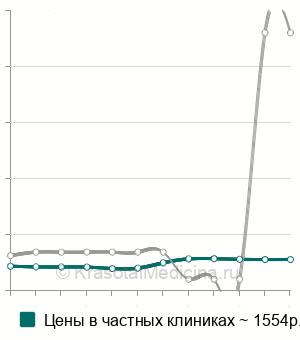 Средняя стоимость анализа на а/т к Scl-70 в Москве
