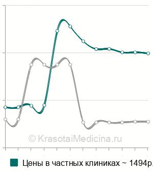 Средняя стоимость анализ на антитела к Ro/SS-A в Москве