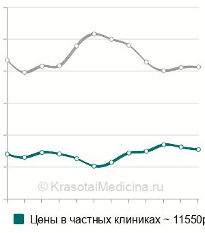 Средняя стоимость ангиография головного мозга в Москве