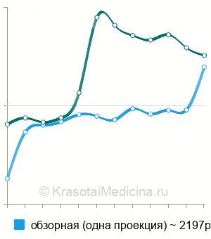 Средняя стоимость рентгенографии легких в Москве