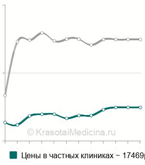 Средняя стоимость ангиография почек в Москве