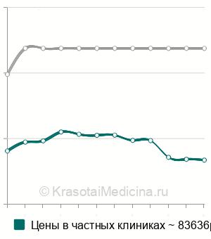 Средняя стоимость прозрачные каппы для выравнивания зубов в Москве