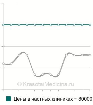 Средняя стоимость эмболизации АВМ головного мозга в Москве