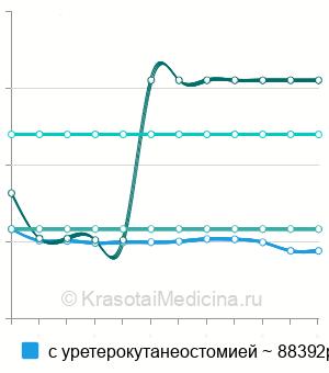 Средняя стоимость радикальная цистэктомия в Москве