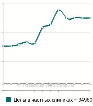 Средняя стоимость иссечение кисты молочной железы в Москве