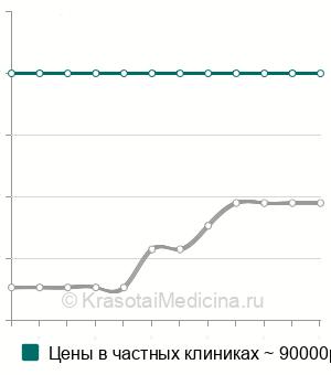 Средняя стоимость рентгенэндоваскулярной окклюзии дефекта МЖП в Москве