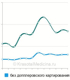 Средняя стоимость УЗИ сердца ребенку в Москве