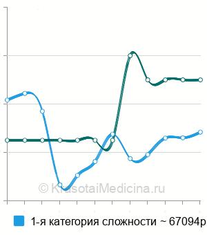 Средняя стоимость операции Булхорн в Москве