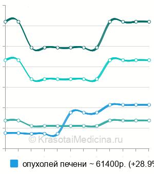 Средняя стоимость химиоэмболизация опухолей в Москве