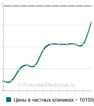 Средняя стоимость бужирование толстой кишки в Москве