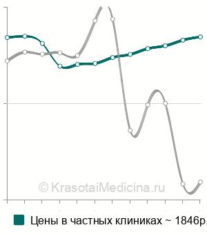 Средняя стоимость удаления кисты конъюнктивы в Москве