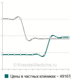 Средняя стоимость ринохейлопластика в Москве