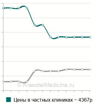 Средняя стоимость КТ головного мозга ребенку в Москве